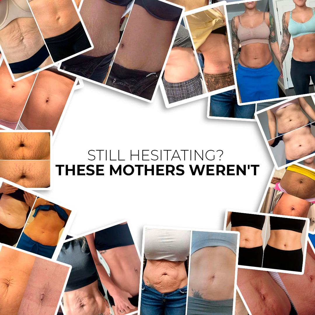 FIRMLY™ |3-Layer Lift Red Light Belt for Firming and Skin Tightening